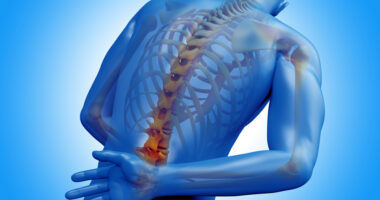 ankylosing spondylitis, anti-TNF