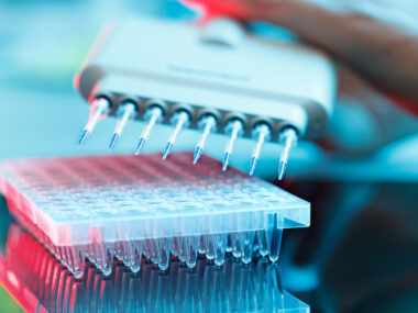 IBD and AS protein study