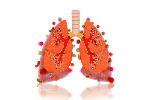 COPD linked to ankylosing spondylitis