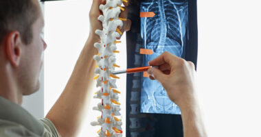 spinal bone formation