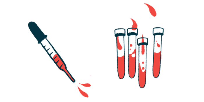 An illustration shows blood in a dropper next to four vials that also contain blood.