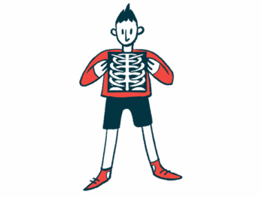 A patient holds up an X-ray of the chest.