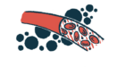 Blood cells are shown flowing through a blood vessel in this illustration.